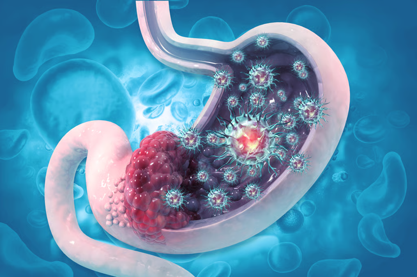 HanchorBio Receives Third Taiwan TFDA Approval for HCB101 Combination Therapy in Advanced Gastric Cancer